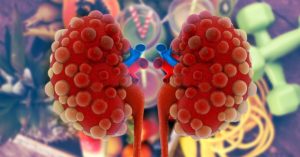 picture of polycystic kidney with background of lifestyle modifications