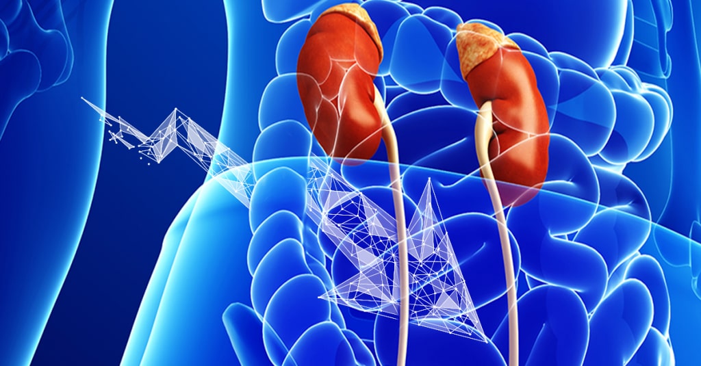 The 5R Protocol Part 2 Replace — Integrative Kidney