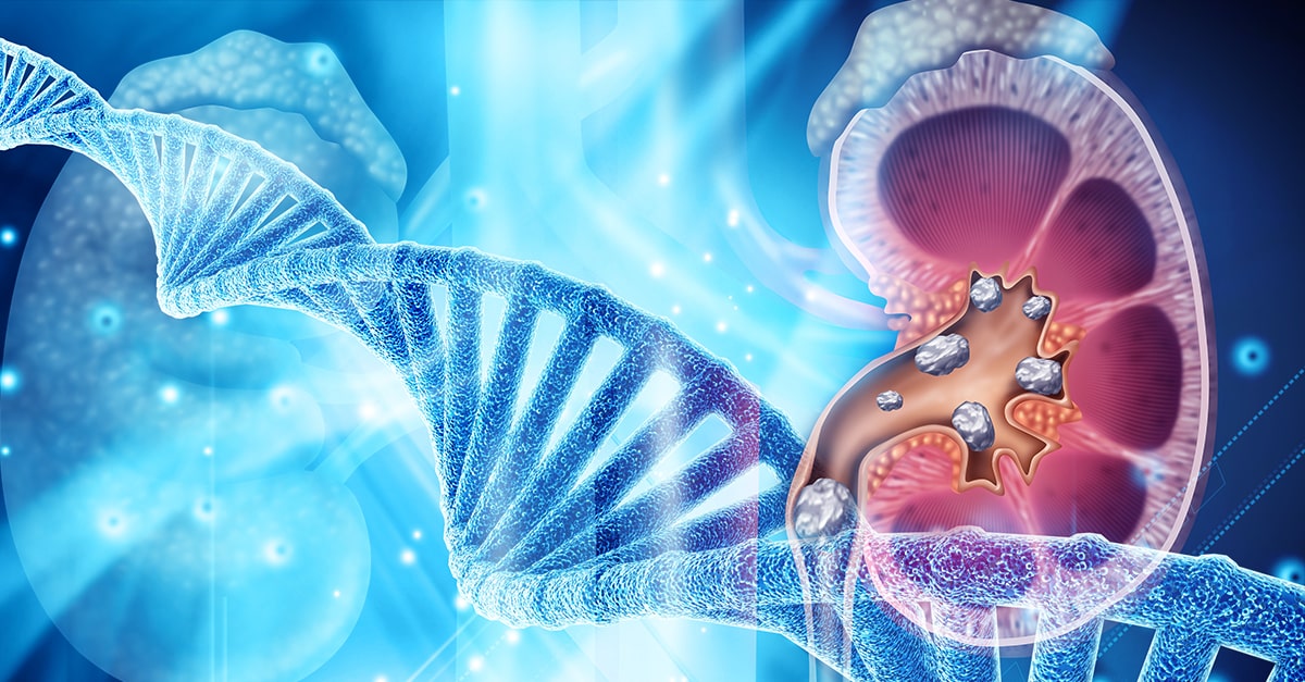 genetics-of-the-gut-kidney-connection-in-kidney-stones-beyond-the