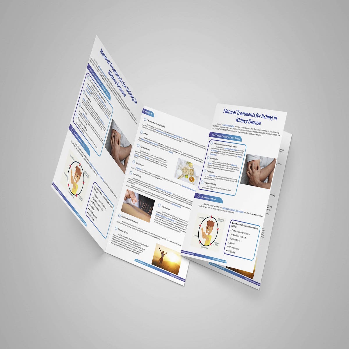 natural treatment for itching in CKD-min-2 Itching