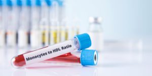 monocyte-to-HDL ratio